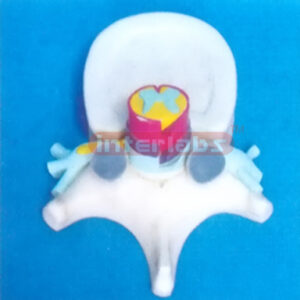 HUMAN THORACIC VERTEBRAE MODEL WITH SPINAL CORD Manufacturers and Suppliers From Ambala India