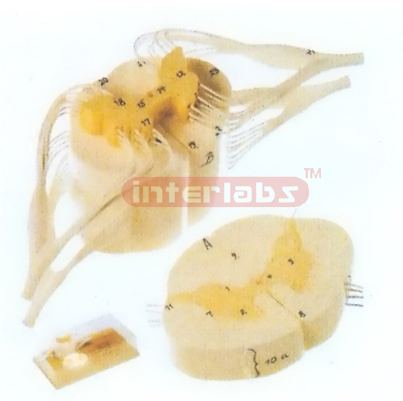 HUMAN SPINAL CORD WITH NERVE BRANCHES Manufacturers and Suppliers From Ambala India