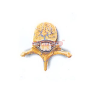 VEINS MODEL OF SPINAL CORD Manufacturers and Suppliers From Ambala India
