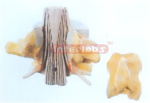 HUMAN LUMBAR VERTEBRAE MODEL WITH LUMBAR REGION SPINAL CORD Manufacturers and Suppliers From Ambala India