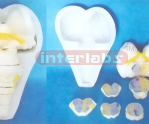 THE TRANSVERSE SECTION MODEL OF THE BRAIN STEM WITH BASE (9 PCS) Manufacturers and Suppliers From Ambala India