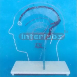 SOLID CONFIGURATION OF MAGNIFIED ENCEPHALIC OUTER VEIN ANASTOMOSIS Manufacturers and Suppliers From Ambala India