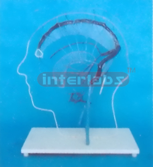 SOLID CONFIGURATION OF MAGNIFIED ENCEPHALIC OUTER VEIN ANASTOMOSIS Manufacturers and Suppliers From Ambala India