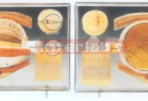 EYE DEMONSTRATION PLATE Manufacturers and Suppliers From Ambala India