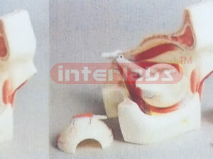MAGNIFIED EYEBALL WITH ORBIT 3 TIME Manufacturers and Suppliers From Ambala India