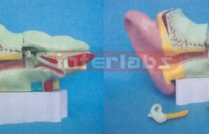 35.6 x 17.8 x 26 cm LEFT EAR