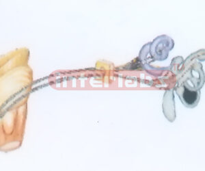 HUMAN MODEL OF THE VESTIBUL COHLEAR NERVE Manufacturers and Suppliers From Ambala India