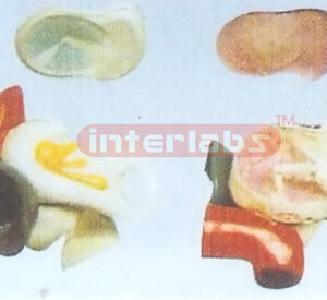 SMALL EXPANSION EAR MODEL Manufacturers and Suppliers From Ambala India