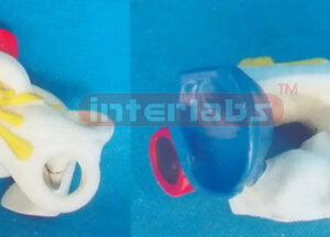 MIDDLE EXPANSION EAR MODEL Manufacturers and Suppliers From Ambala India
