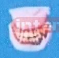 SMOKELESS TOBACCO MOUTH MODEL SIZE : 8.8 x 8.5 x 10cm Manufacturers and Suppliers From Ambala India