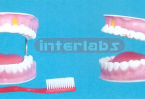 FEATHEREDGE GIANT DENTAL CARE MODEL WITHOUT TOOTH GAP FIXED WITH TONGUE (ORAL HYGIENE SET