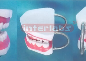 MIDDLE-LITTLE SANS TOOTH GAP FIXED DENTAL CARE MODEL OF THE GAP FIXED WITH TONGE Manufacturers and Suppliers From Ambala India