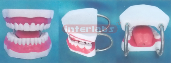 MIDDLE-LITTLE SANS TOOTH GAP FIXED DENTAL CARE MODEL OF THE GAP FIXED WITH TONGE Manufacturers and Suppliers From Ambala India