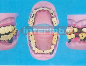 SMOKELESS TOBACCO MOUTH MODEL Manufacturers and Suppliers From Ambala India