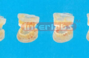 TRANSPARENT ADULT TOOTH MODEL Manufacturers and Suppliers From Ambala India