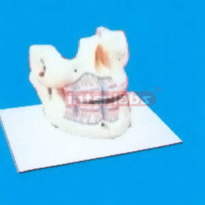 TYPE WHOLY MANENT TEETH MODEL Manufacturers and Suppliers From Ambala India