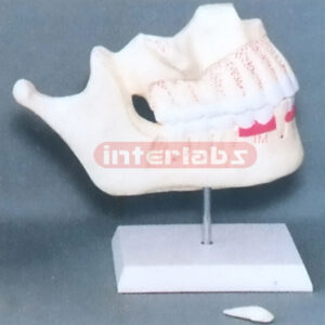 CHILDEN TEETH Manufacturers and Suppliers From Ambala India