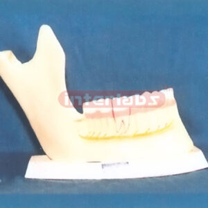 ADULT MANENTTEETH Manufacturers and Suppliers From Ambala India