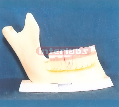 ADULT MANENTTEETH Manufacturers and Suppliers From Ambala India