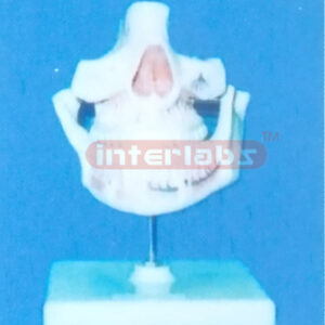 COMPARATIVE ADULT DENTURES (WEST-TYPE) Manufacturers and Suppliers From Ambala India