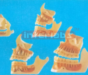 DEVELOPMENT OF A SET OF TEETH Manufacturers and Suppliers From Ambala India