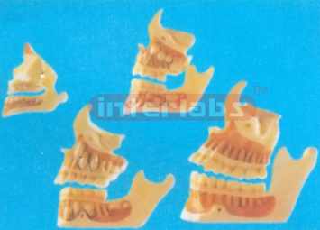 DEVELOPMENT OF A SET OF TEETH Manufacturers and Suppliers From Ambala India