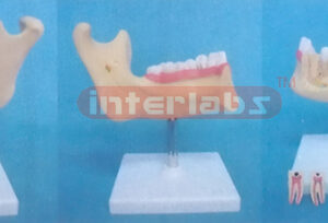 MINI MANENTTEETH AND LOWER JAW (MINI DELUXE TEETH AND JAW MODEL) Manufacturers and Suppliers From Ambala India