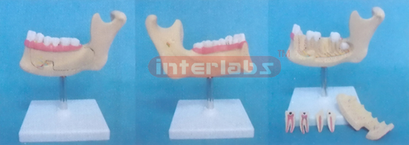 MINI MANENTTEETH AND LOWER JAW (MINI DELUXE TEETH AND JAW MODEL) Manufacturers and Suppliers From Ambala India