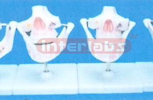 EGUITABLE DENTITION DEVELOPMENT (4 PCS) Manufacturers and Suppliers From Ambala India
