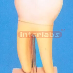 GIANT MOLAR WITH STAND Manufacturers and Suppliers From Ambala India