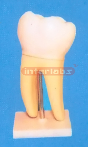 GIANT MOLAR WITH STAND Manufacturers and Suppliers From Ambala India