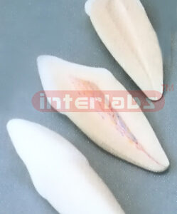 BIG SERIES OF TEETH 3 PCS / SET. Manufacturers and Suppliers From Ambala India