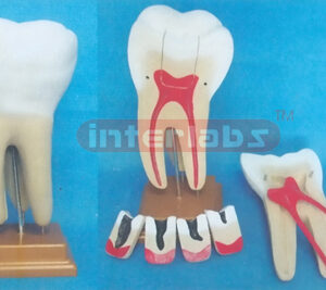 GIANT THREE ROOT MOLAR Manufacturers and Suppliers From Ambala India
