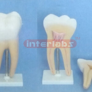 GIANT MOLAR