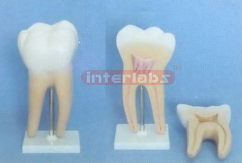 GIANT MOLAR