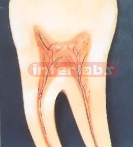 HALFLINGS CONSTANT TEETH Manufacturers and Suppliers From Ambala India