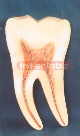 HALFLINGS CONSTANT TEETH Manufacturers and Suppliers From Ambala India