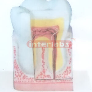 HUMAN TOOTH STRUCTURE MODEL Manufacturers and Suppliers From Ambala India