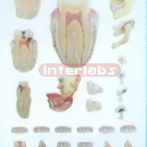 HANGING HUMAN DEMONSTRATING MODEL OF THE TEETH AND JAW Manufacturers and Suppliers From Ambala India