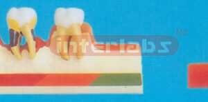 CLASSIFIED PARADONTOSIS MODEL Manufacturers and Suppliers From Ambala India