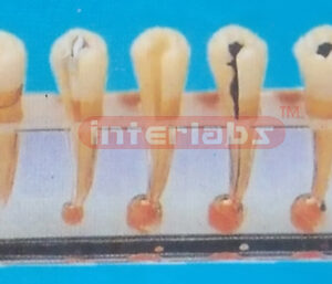 ENDODONTIC DISEASE CLINICAL MODEL Manufacturers and Suppliers From Ambala India