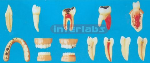 TEETH DISEASE SERIES MODEL Manufacturers and Suppliers From Ambala India