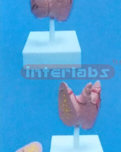 LITTLE GL. THYROIDEA Manufacturers and Suppliers From Ambala India
