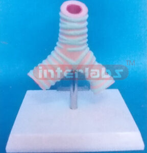 ASTHMA DISEASE BRONCHI MODEL Manufacturers and Suppliers From Ambala India