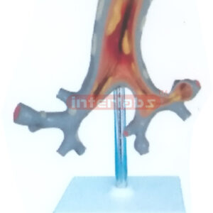 HUMAN DISEASE Manufacturers and Suppliers From Ambala India