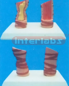 HUMAN HEALTH AND DISEASED TRACHEA COMPARISON MODELS (A TYPE) Manufacturers and Suppliers From Ambala India