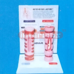 HUMAN HEALTH AND DISEASED TRACHEA COMPARISON MODELS (B TYPE) Manufacturers and Suppliers From Ambala India