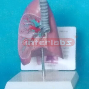 MIX TYPE ANATOMICAL TRACHEA / LUNG MODEL WITH DESCRIPTION PLATE Manufacturers and Suppliers From Ambala India