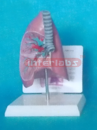 MIX TYPE ANATOMICAL TRACHEA / LUNG MODEL WITH DESCRIPTION PLATE Manufacturers and Suppliers From Ambala India