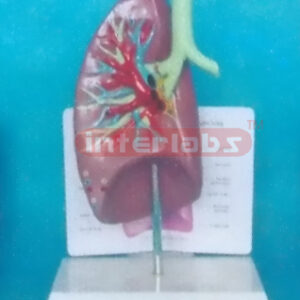 ANATOMICAL TRACHEA / LUNG MODEL WITH DESCRIPTION PLATE Manufacturers and Suppliers From Ambala India